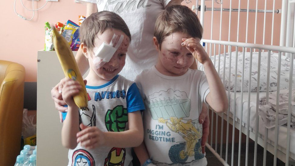 Обединените усилия на лекари в Украйна и Полша спасиха зрението на майка и двете ѝ деца