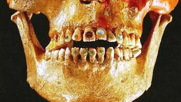 Как залепването на скъпоценни камъни по зъбите е спомагало за здравето на индианците маи