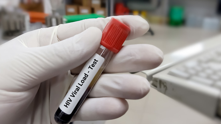Първи излекуван от ХИВ с трансплантация на „нормални“ стволови клетки