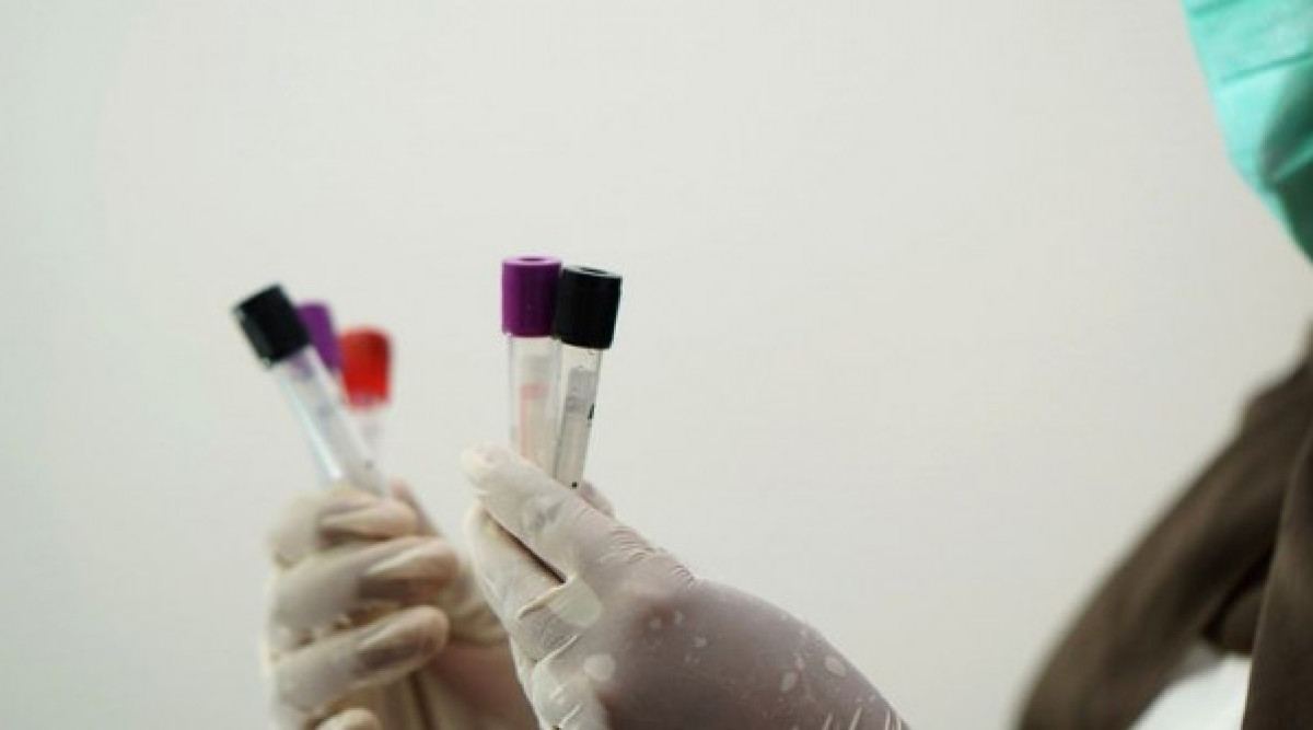 Словакия ще тества за коронавирус всички граждани на възраст над 10 години