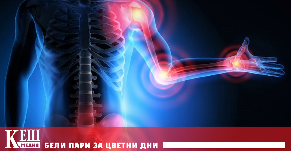 Според британската национална служба за здравеопазване NHS от остеоартрит страдат