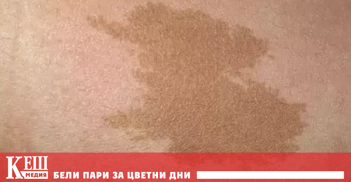 Изследователи под ръководството на сътрудници от Масачузетската многопрофилна болница MGH