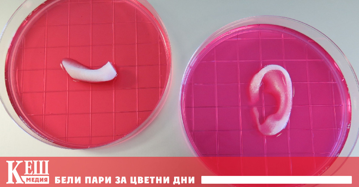 Новаторската процедура е приложена на 20-годишна жена, родена със ...
