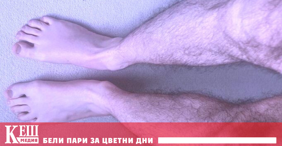 А сега учените откриха нов и необичаен симптом известен като