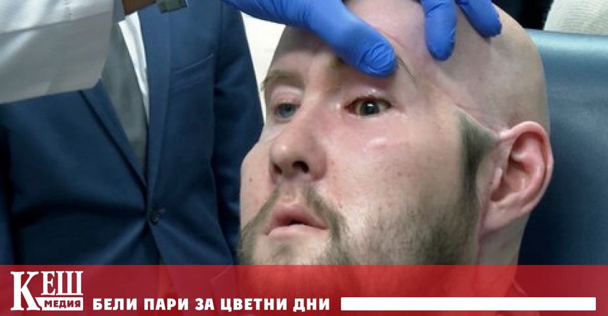 Хирурзите от ню йоркският медицински център NYU Langone Health казват че