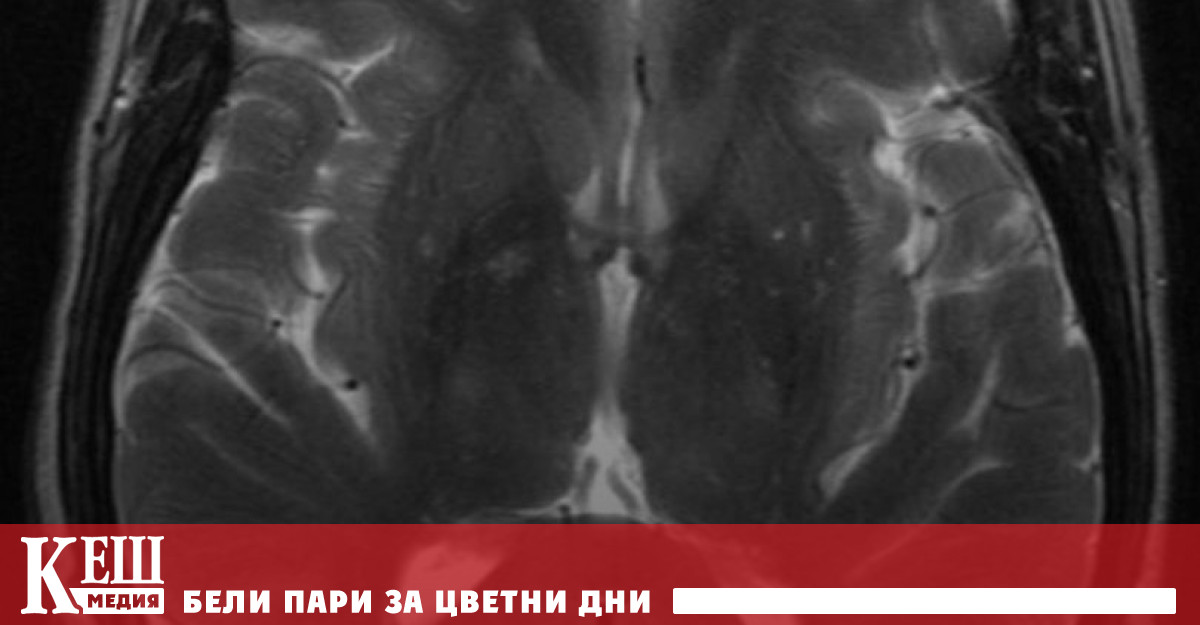 Изследователи от Университетския колеж в Лондон съобщиха за първото по