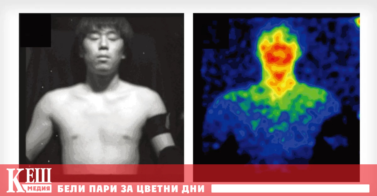 За реален случай на т нар биолуминисценция съобщава италианският лекар