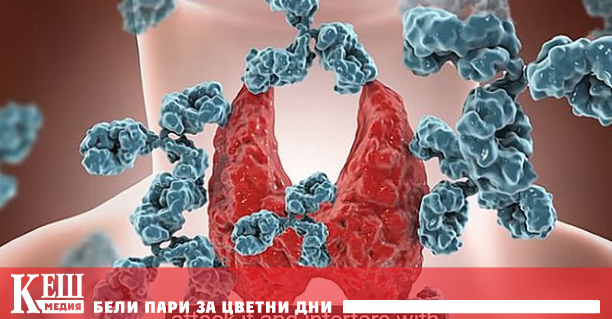 Лекар разкрива как да разпознаваме по гласа рака на щитовидната жлеза