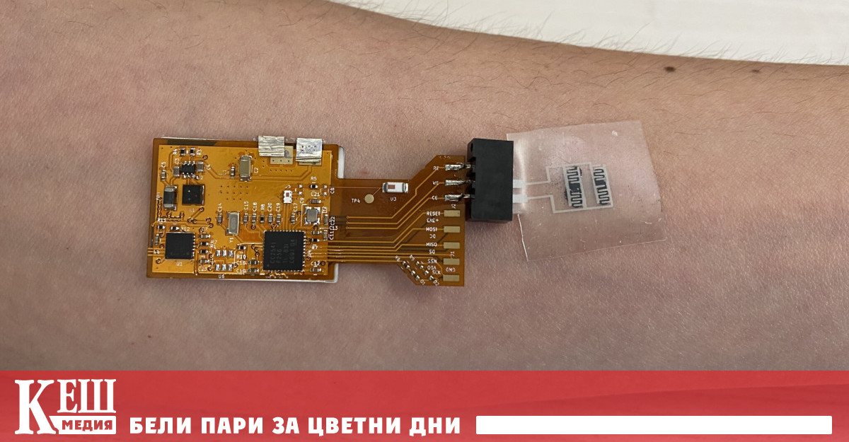 Наностикер открива туберкулоза по миризмата на кожата