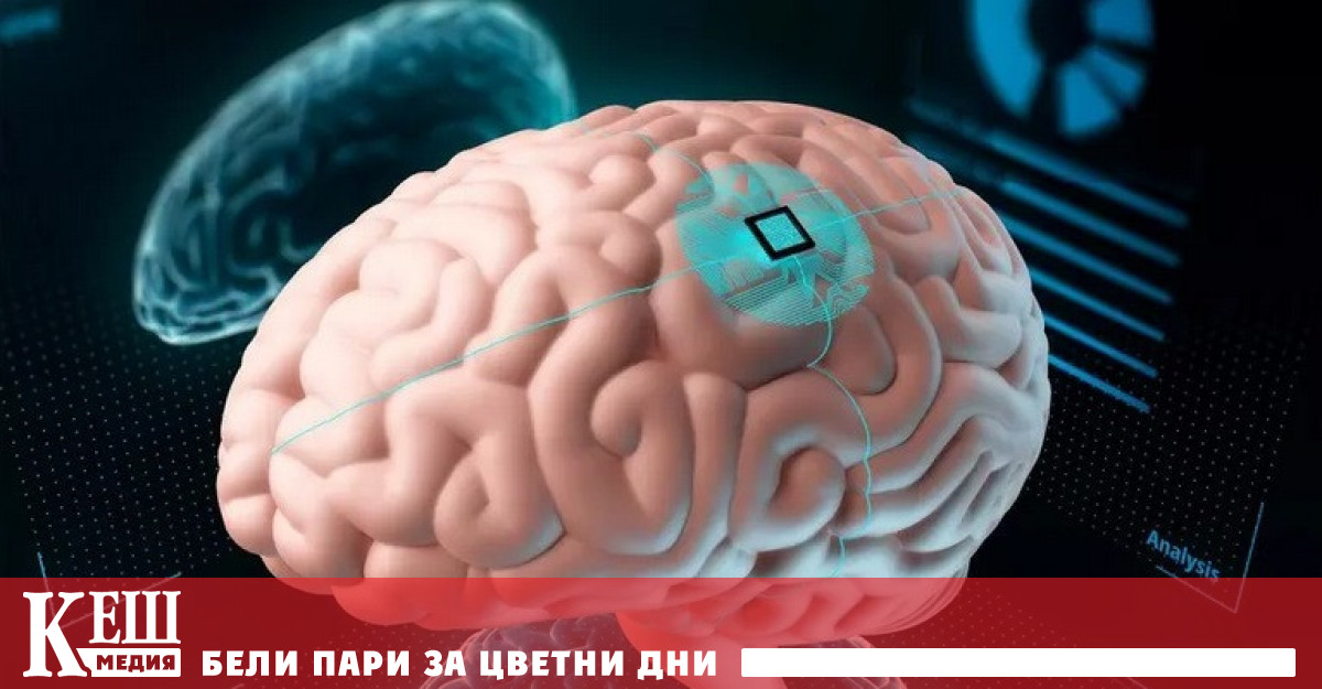 Какви са ползите и заплахите при имплантирането на електронни чипове в мозъка