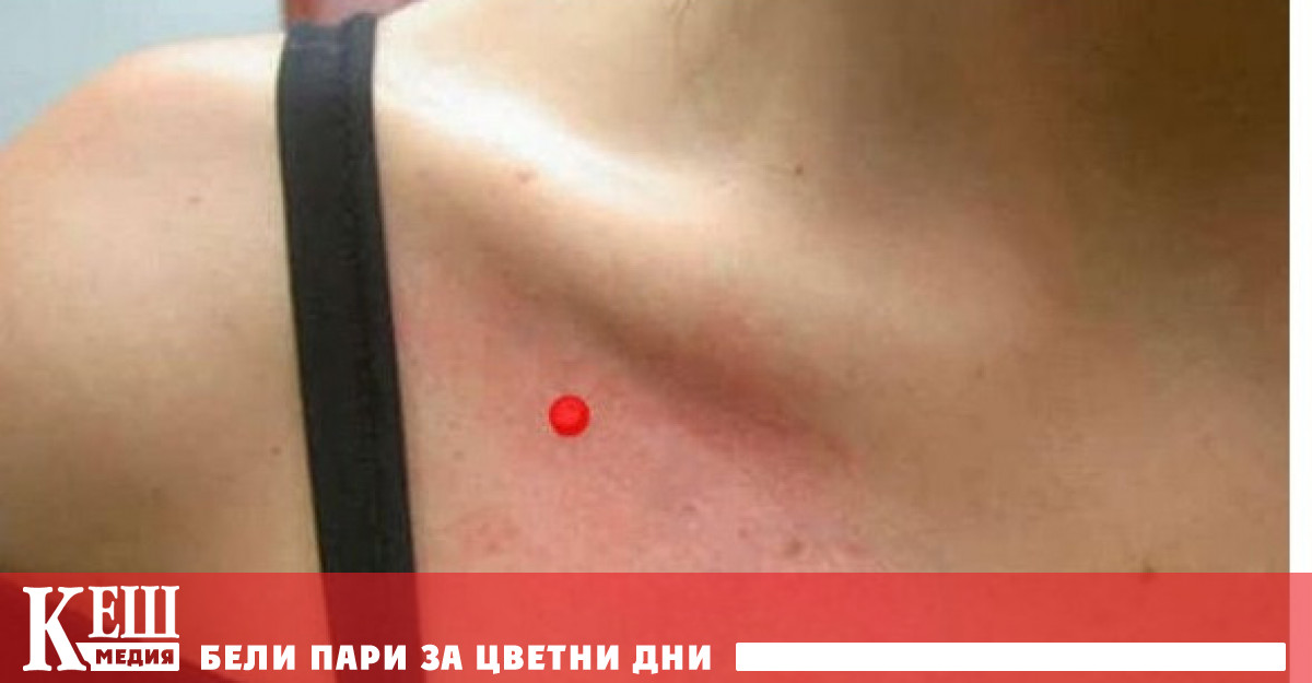 Вълшебната точка, помагаща да се избавим от наднорменото тегло