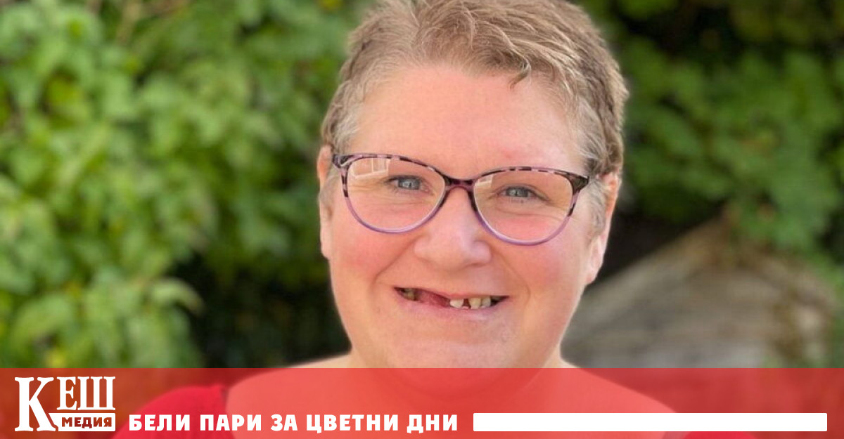 Британка не намери безплатен зъболекар и си извади сама 11 зъба