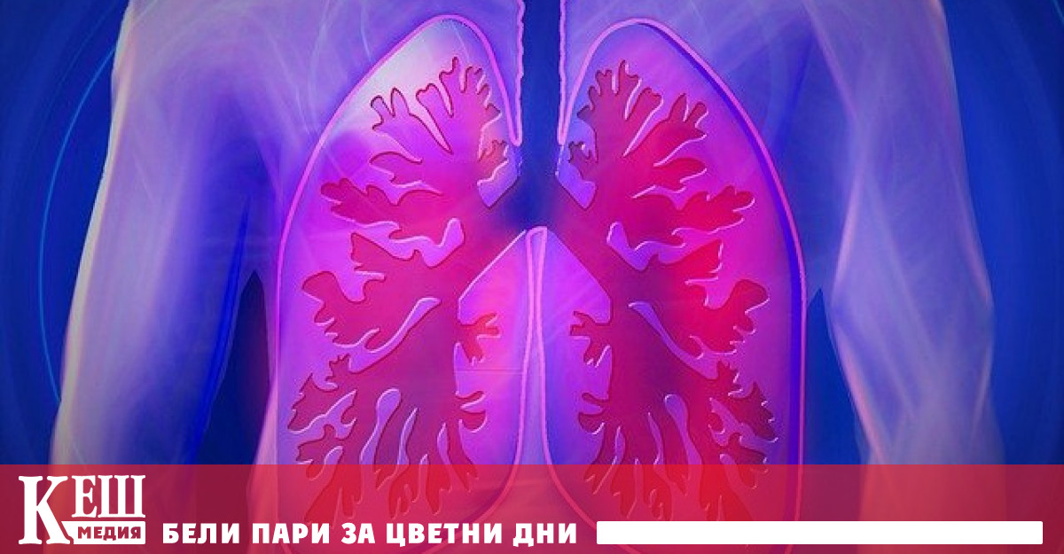 Лекари откриха странен симптом на рак на белия дроб