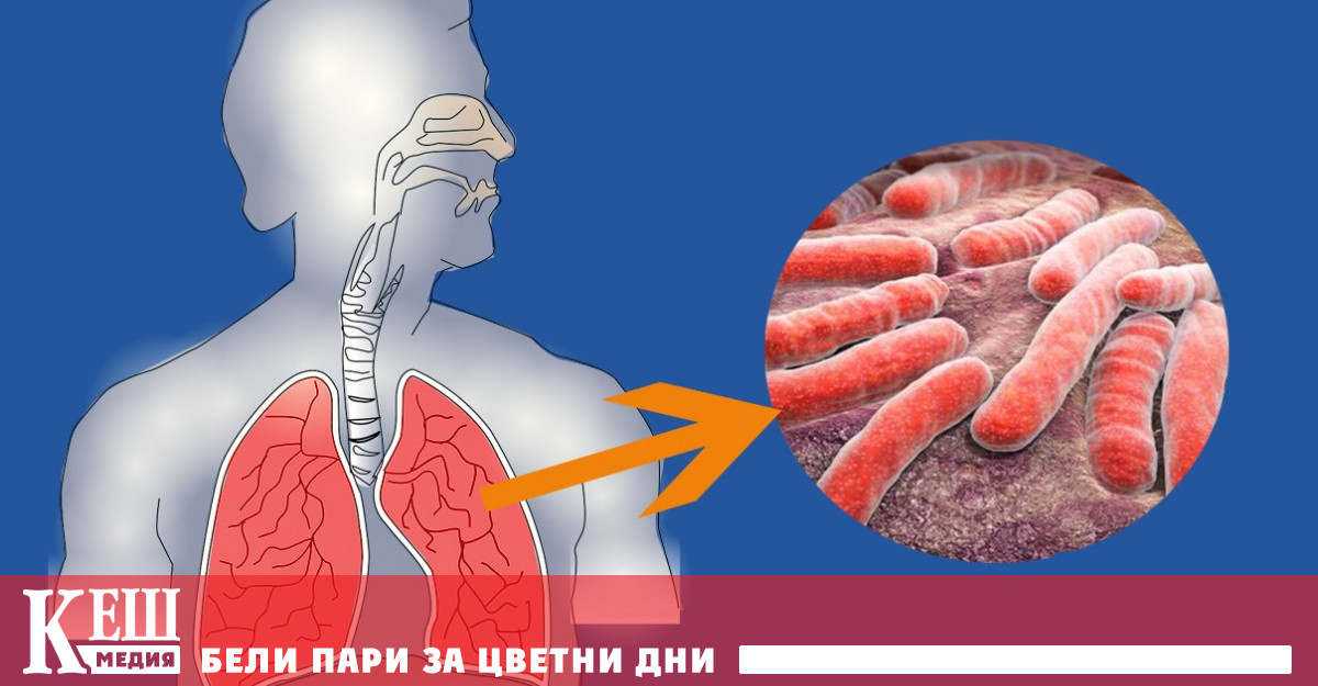„Следващата вълна след Covid ще е от туберкулоза“