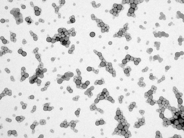 Учени откриха микропластмаси в човешки кръвни проби