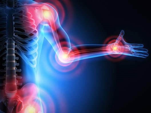 Ново изследване утвърди упражненията като най-добро лечение при остеоартрит