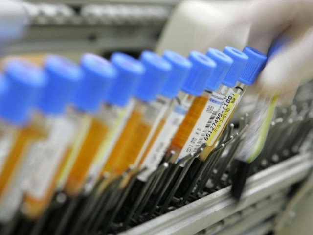Президент на фармацевтичен стартъп е осъден за фалшиви тестове за коронавирус