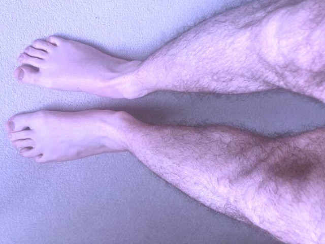 Синдром на сините крака: Нов симптом на COVID-19, за който трябва да знаете