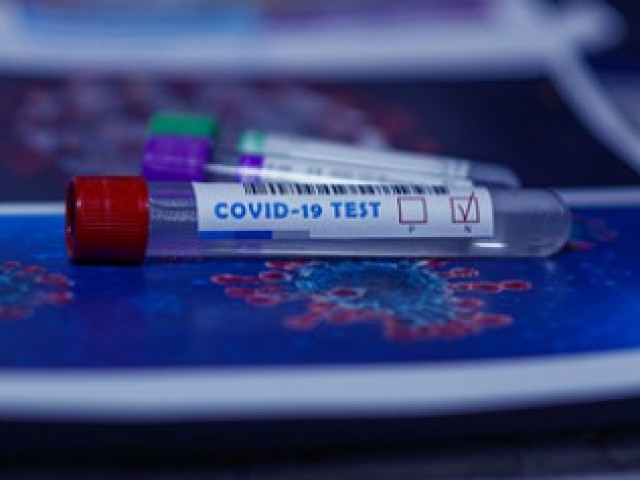 Швейцарската Roche пуска нов бърз тест за коронавирус в края на септември