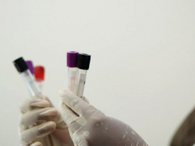 Словакия ще тества за коронавирус всички граждани на възраст над 10 години