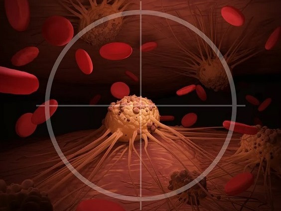 Изчезването на три вида рак през следващите десетилетия предричат от СЗО