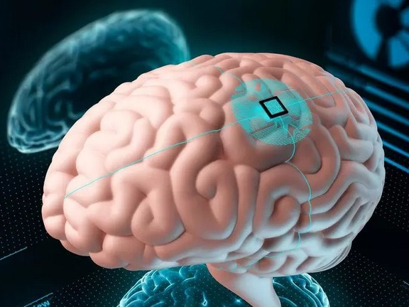 Какви са ползите и заплахите при имплантирането на електронни чипове в мозъка